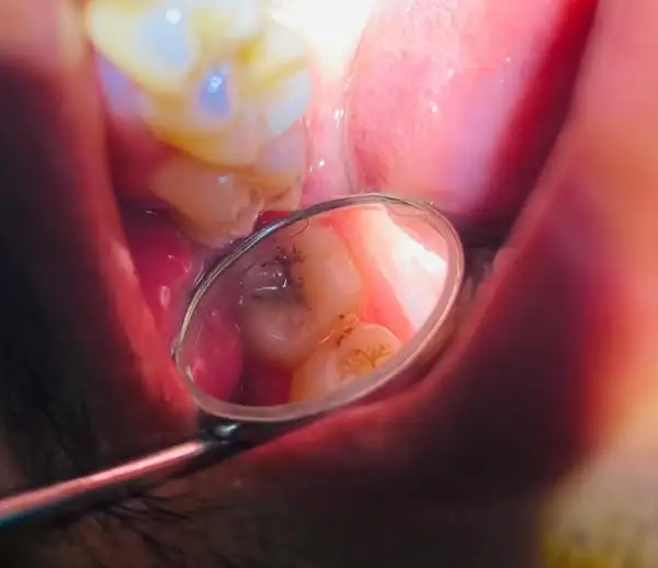 Precision Dental Care - Advanced Restorative Treatment